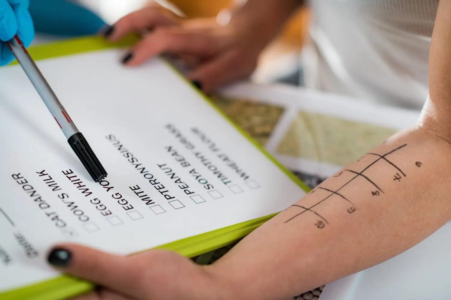 Lokalne referenda procedury inicjatywy obywatelskie demokracja